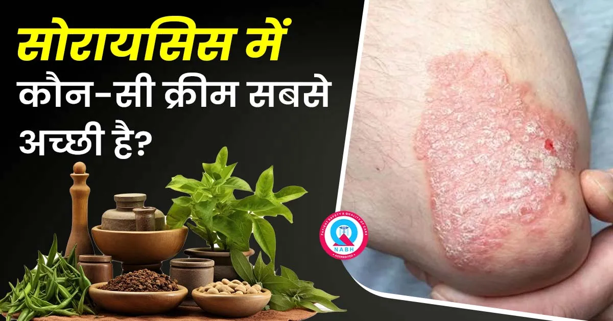 सोरायसिस-में-कौन-सी-क्रीम-सबसे-अच्छी-है